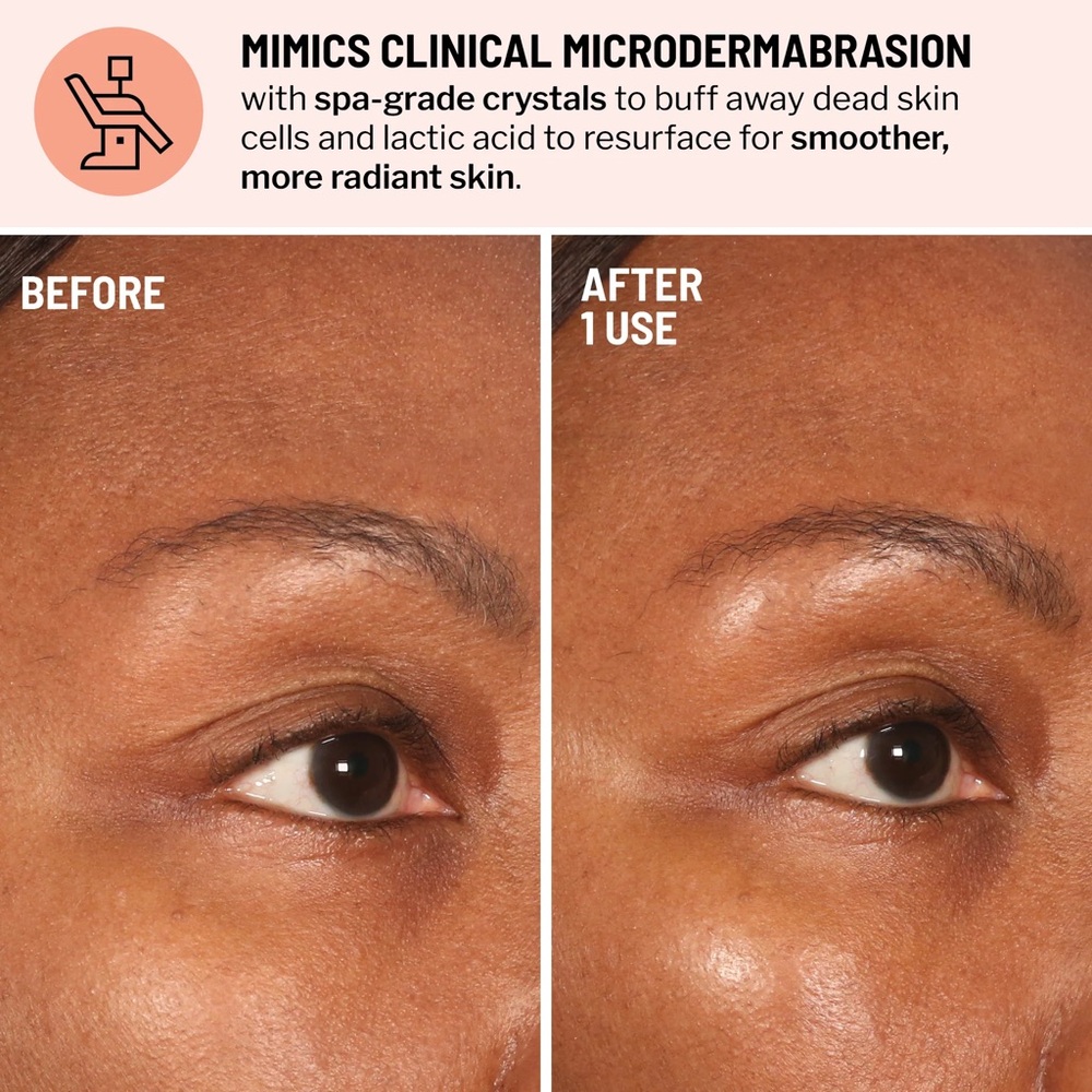 Dr. Brandt Advanced Microdermabrasion Face Exfoliator | NIB - Picture 2 of 8